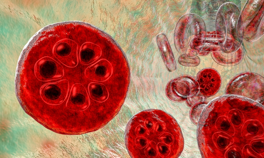 A group of malaria-infected red blood cells.