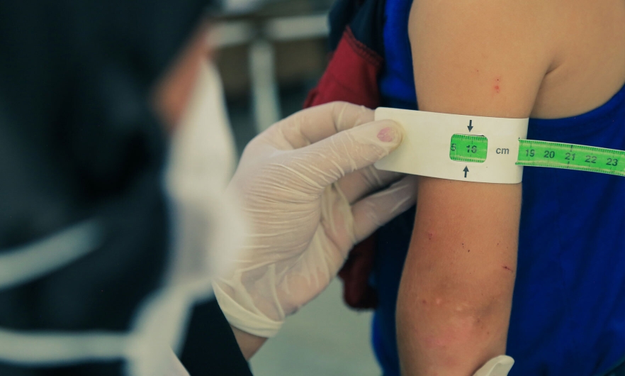 Undernourished child getting arm measured