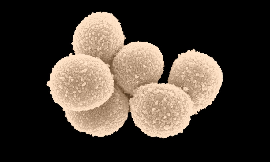 scanning electron micrograph showing a cluster of six round cells