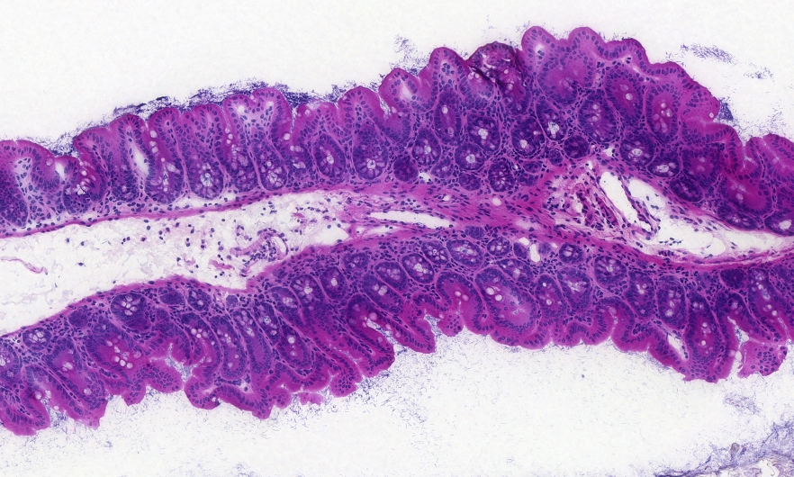 Microscope section showing 622A_cecum through a healthy mouse cecum stained with Haematoxylin-eosin