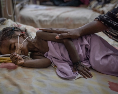 Two-year-old Riham Ata, who was admitted from a recently liberated area of Khartoum, lies on a gurney in one of Al-Buluk Hospital&#039;s severe malnutrition wards, in Omdurman, Sudan, on April 26, 2025