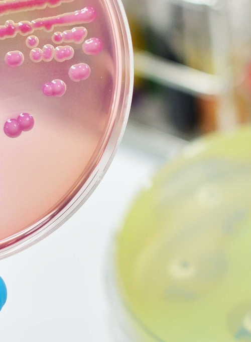 A gloved hand holds a petri dish with streaked bacterial colonies, above a lab bench with stacks of plates and racks of capped test tubes