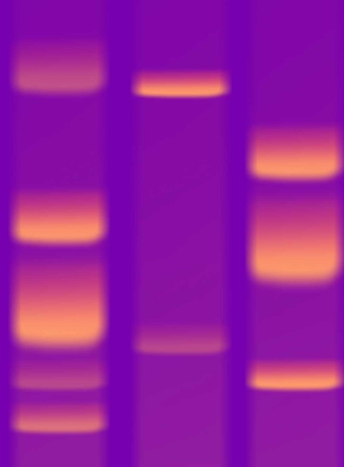 An electrophoresis gel, glowing orange bands on a purple background