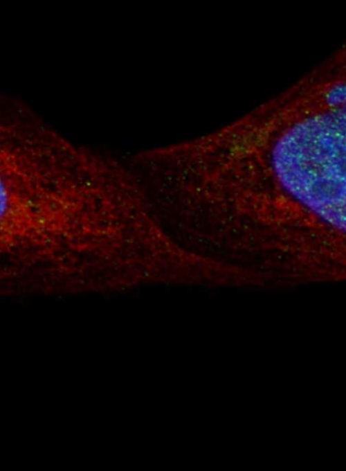 Microscopy image of three cells: mottled blue oval centers surrounded by red strands stretching to fill the cell, speckled with tiny green dots, on a black background  