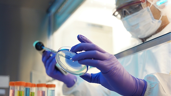 researcher looking at a petri dish