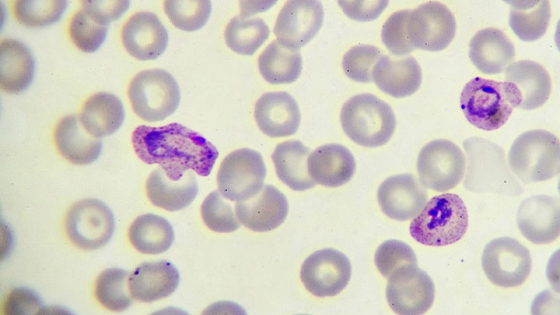 plasmodium parasite under a microscope