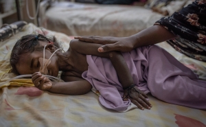 Two-year-old Riham Ata, who was admitted from a recently liberated area of Khartoum, lies on a gurney in one of Al-Buluk Hospital&#039;s severe malnutrition wards, in Omdurman, Sudan, on April 26, 2025