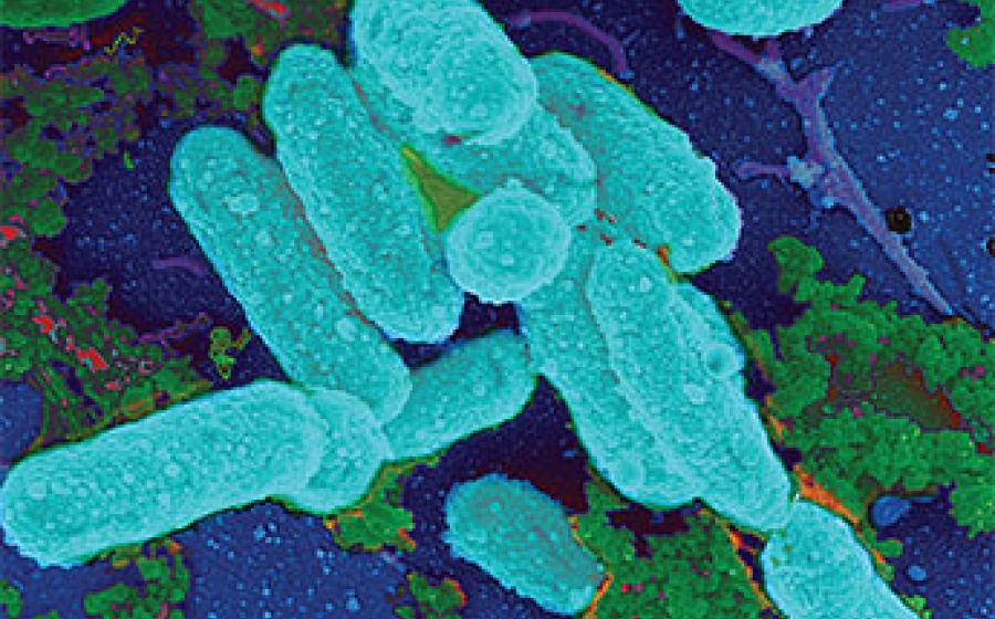 Then: Genetic Pioneers - Uncover the role of genes in causing and preventing disease in populations