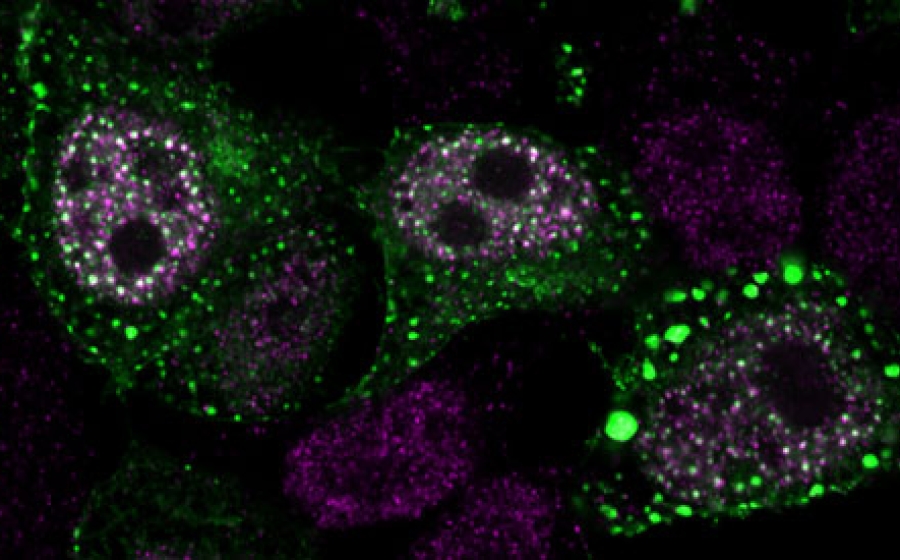 A microscopy image of cells, labeled with purple and green fluorescence. There are several roughly oval clusters of small dots of purple, around some of them is a region with green dots, some of which are larger, looking like drops of color.