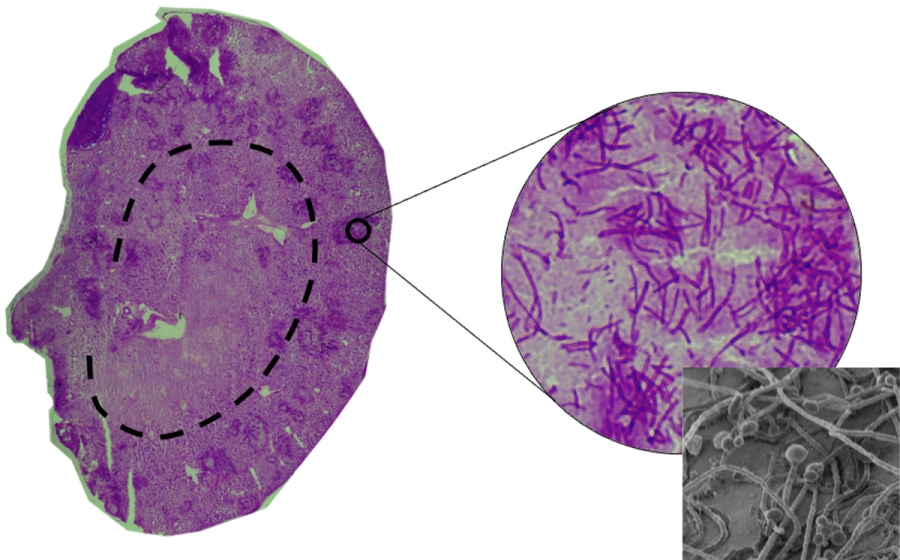 A mouse kidney cross section with purple staining. A zoomed in portion shows dark strands in tangles. An inset scanning microscope images shows thn strands capped with rounded bulbs. 