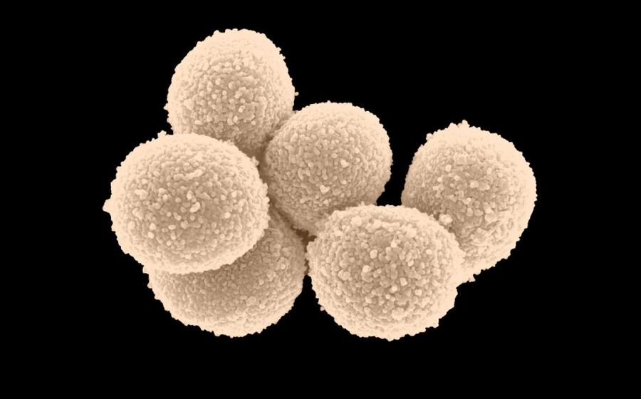 scanning electron micrograph showing a cluster of six round cells
