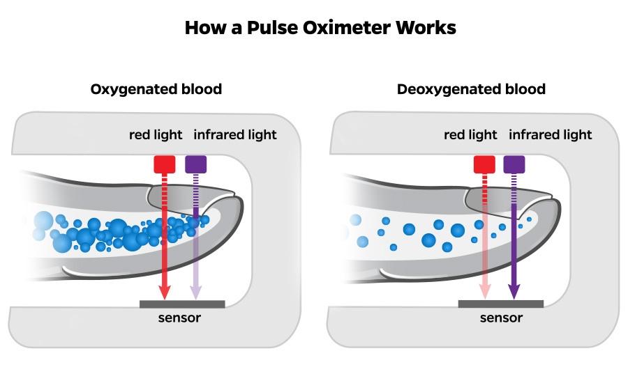 Side-by-side diagram of pulse oximeter function on oxygenated blood versus deoxygenated blood.