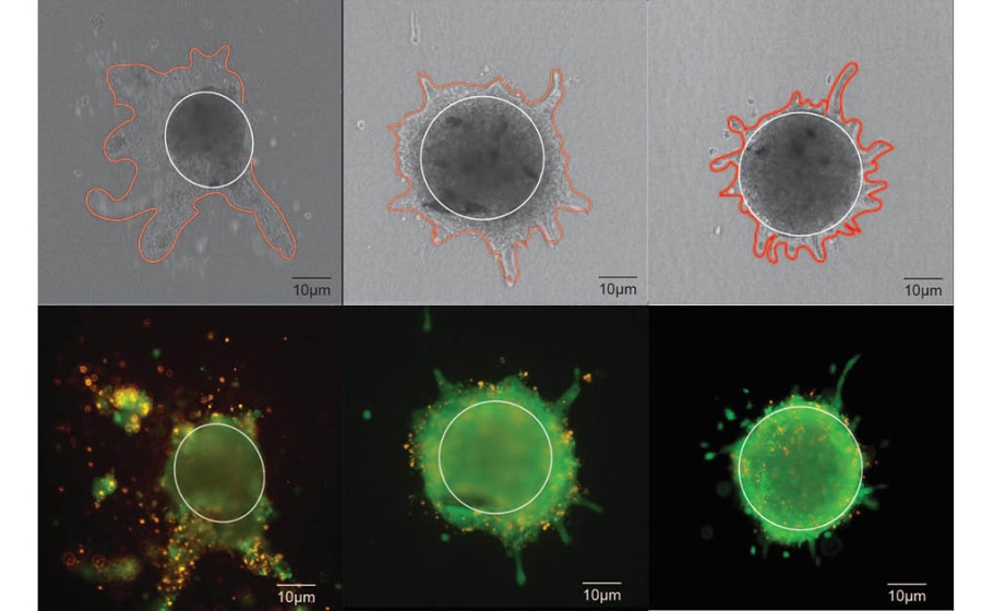 three sets of invasion assay images of spheroid, each a dense circular center with tendrils extending: a top brightfield images, shades of grey with the tendrils outlined in red drawn lines, paired with a fluorescent image, bright green, yellows and reds on a black background.