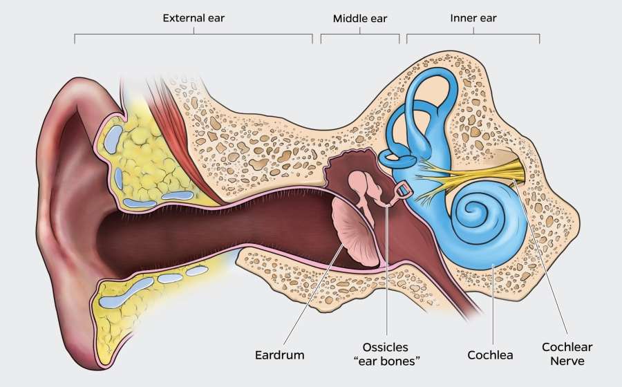Annotated diagram of human ear shows external ear, leading to the middle ear which includes the eardrum and ossicles, or ear bones, and then to the inner ear, which includes the cochlea and cochlear nerve.