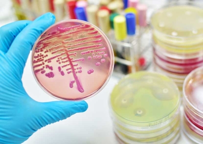 A gloved hand holds a petri dish with streaked bacterial colonies, above a lab bench with stacks of plates with lawns of bacterial growth, with gaps around antibiotic-soaked disks