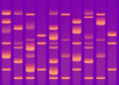 An electrophoresis gel, glowing orange bands on a purple background