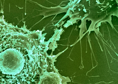 Green tinted microscopy image of roughly spherical T lymphocytes attaching to large, irregularly shaped cancer cells